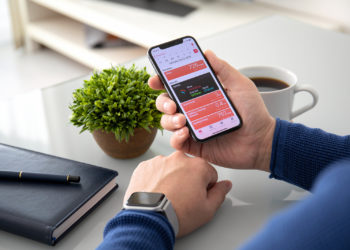 Apple Watch blood sugar monitoring