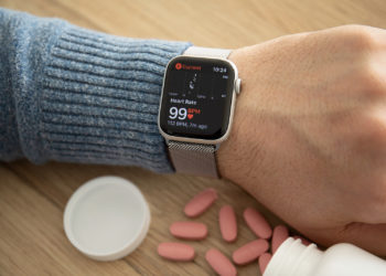 Apple Watch Series 8: Finally with blood sugar monitoring?