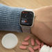 Apple Watch Series 8: Finally with blood sugar monitoring?