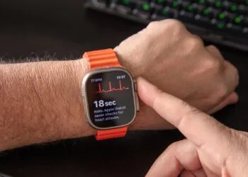 Apple Watch Vorhofflimmern