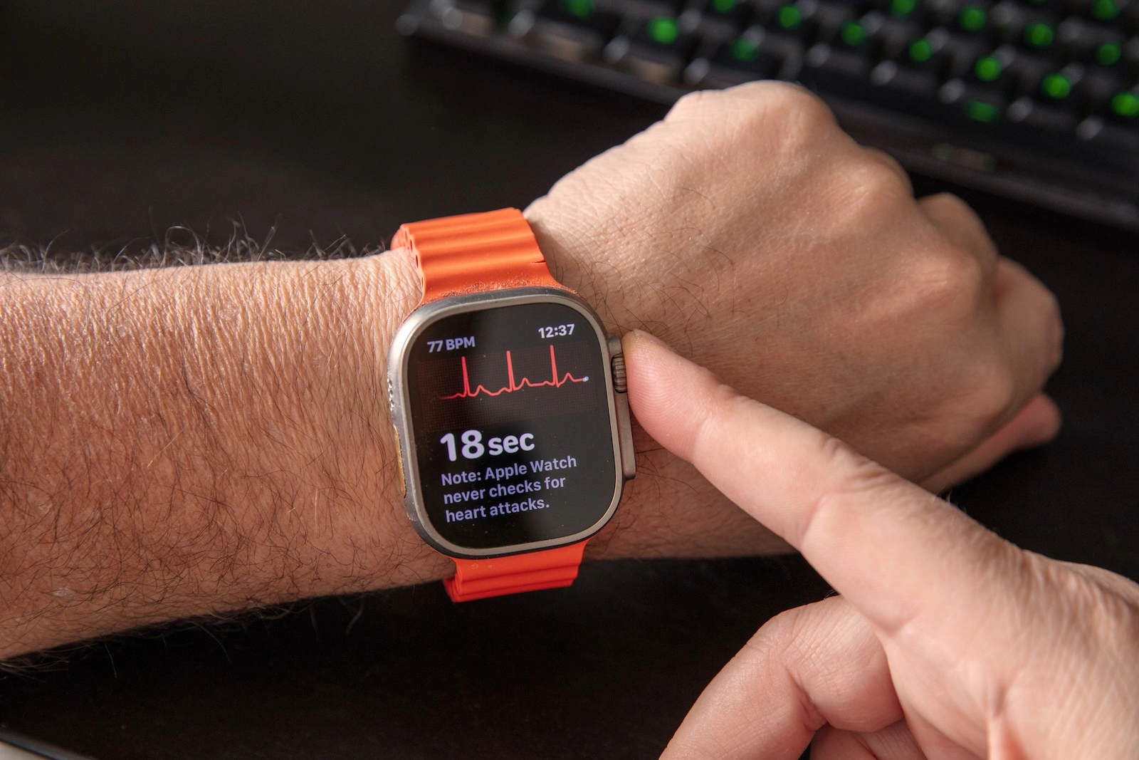 Apple Watch Vorhofflimmern