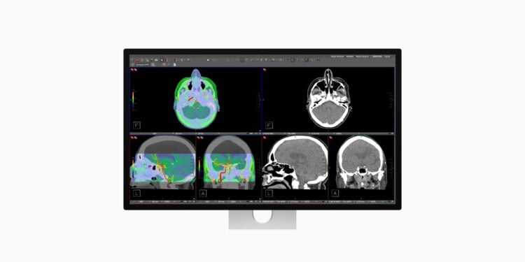 Studio Display XDR Apple